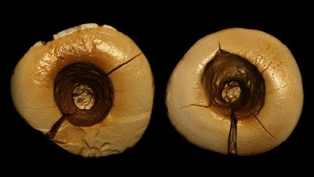 Ep escaneolos dientesbitumen 620x350