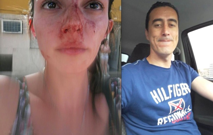 Sanchez golpea a areli alonso argentinga rosario
