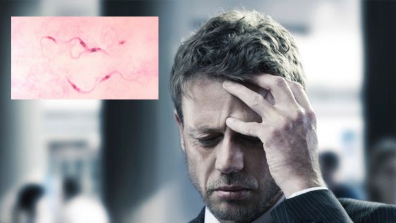 Dolor de cabeza parasitos