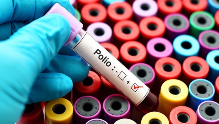 Virus polio