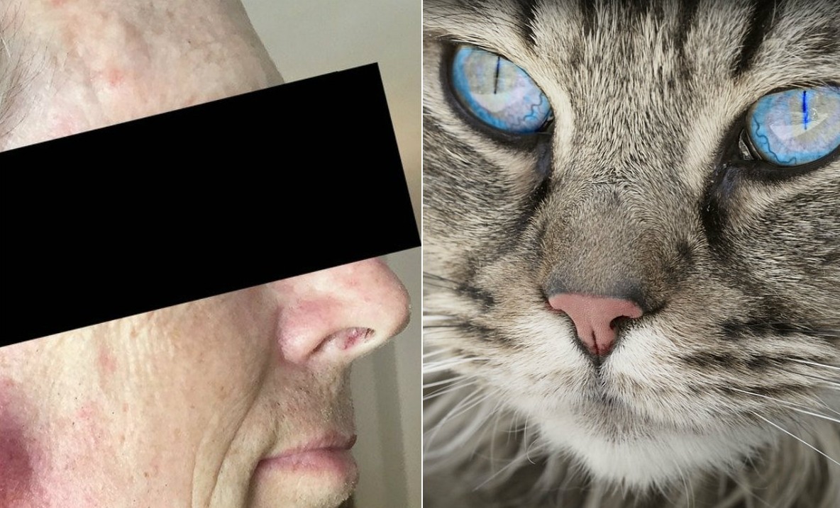 Gato infecta due o tularemia